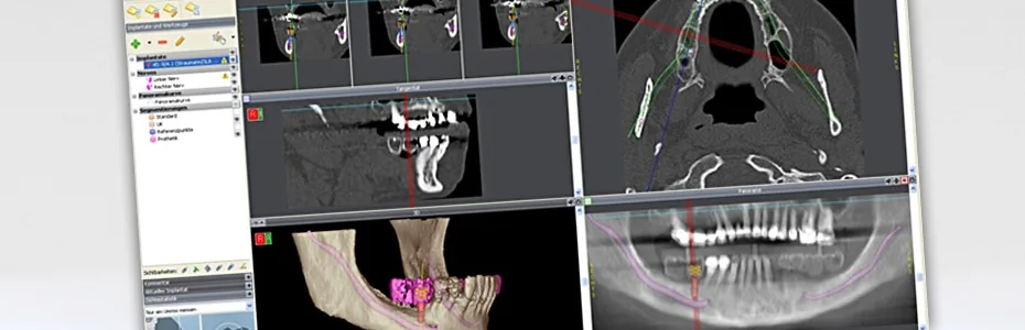 Erstklassige und umfassende Diagnosen sind die Grundlage, um eine Planung und Behandlung so pr&auml;zise wie m&ouml;glich zu gestalten.