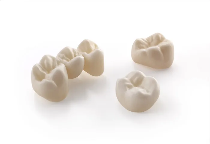 Vollkeramische, metallfreie Implantatprothetik